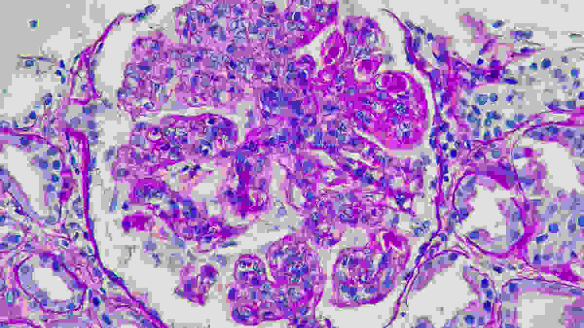 AdobeStock_441716844-1600x900